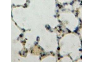 Used in DAB staining on fromalin fixed paraffin-embedded Lung tissue (KLF4 antibody  (AA 187-474))