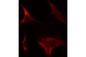 ABIN6275272 staining HeLa by IF/ICC. (NDUFA9 antibody  (Internal Region))