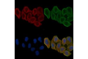 ABIN6262097 and ABIN6266556 staining Hela cells(24h of starvation treatment) by IF/ICC. (HSPA9 antibody  (C-Term))