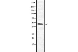 Western blot analysis of HPD using K562 whole cell lysates (HPD antibody  (C-Term))