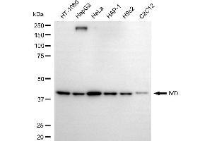 anti-Isovaleryl-CoA Dehydrogenase (IVD) antibody