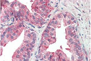 ABIN570690 (5µg/ml) staining of paraffin embedded Human Prostate. (KIF6 antibody  (Internal Region))