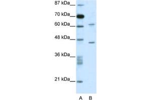 Western Blotting (WB) image for anti-TRM1 tRNA Methyltransferase 1-Like (TRMT1L) antibody (ABIN2460173)