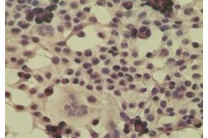 Image no. 3 for anti-Cylindromatosis (Turban Tumor Syndrome) (CYLD) (AA 32-45) antibody (ABIN200017) (CYLD antibody  (AA 32-45))