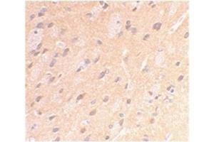Image no. 2 for anti-Amyloid beta (A4) Precursor Protein (APP) (AA 737-751) antibody (ABIN319013)