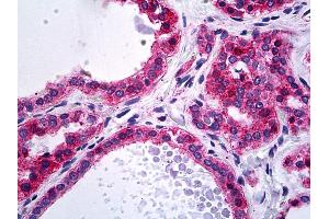 Anti-ACTN4 / Alpha-Actinin-4 antibody IHC of human thyroid. (alpha Actinin 4 antibody  (AA 592-702))