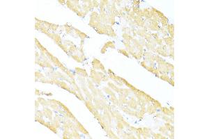 Immunohistochemistry of paraffin-embedded rat heart using UQCC2 antibody  at dilution of 1:100 (40x lens). (MNF1 antibody  (AA 14-126))