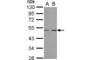 Western Blotting (WB) image for anti-SET Domain Containing (Lysine Methyltransferase) 7 (SETD7) (AA 1-203) antibody (ABIN1500902) (SETD7 antibody  (AA 1-203))