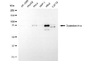 anti-Dystrobrevin alpha (DTNA) antibody
