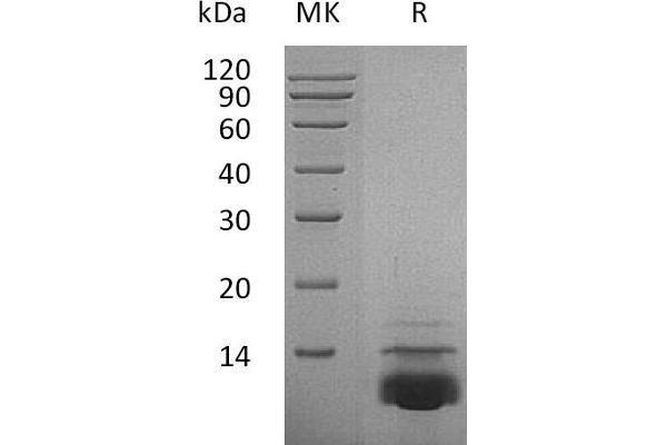 CXCL5 Protein