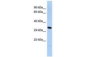Image no. 1 for anti-Forkhead Box K2 (FOXK2) (AA 276-303) antibody (ABIN6742939) (Forkhead Box K2 antibody  (AA 276-303))