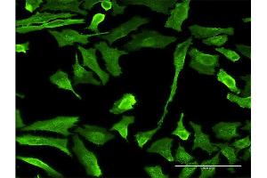 Immunofluorescence of monoclonal antibody to EMR4P on HeLa cell. (EMR4P antibody  (AA 21-93))