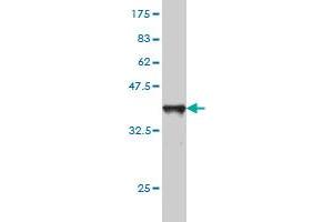 Western Blot detection against Immunogen (37. (SLC44A2 antibody  (AA 123-230))