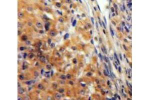 Used in DAB staining on fromalin fixed paraffin-embedded Ovary tissue (KNG1 antibody  (AA 390-644))