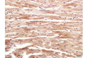 Paraformaldehyde-fixed, paraffin embedded Mouse heart tissue, Antigen retrieval by boiling in sodium citrate buffer(pH6) for 15min, Block endogenous peroxidase by 3% hydrogen peroxide for 20 minutes, Blocking buffer (normal goat serum) at 37°C for 30min, Antibody incubation with RNF169 Polyclonal Antibody, Unconjugated  at 1:400 overnight at 4°C, followed by a conjugated secondary and DAB staining (RNF169 antibody)