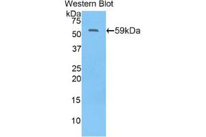 Western blot analysis of the recombinant protein. (N-Acetyl alpha-D-Glucosaminidase (AA 429-710) antibody)