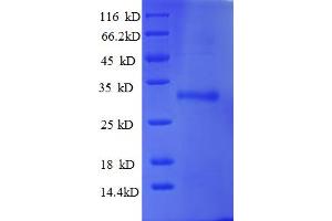 SDS-PAGE (SDS) image for Ubiquitin-Conjugating Enzyme E2W (UBE2W) (AA 1-151), (full length) protein (His-SUMO Tag) (ABIN5711601) (UBE2W Protein (AA 1-151, full length) (His-SUMO Tag))