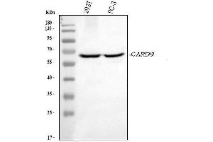 Western blot analysis of CARD9 using anti-CARD9 antibody (ABIN7599386). (CARD9 antibody  (AA 1-429))