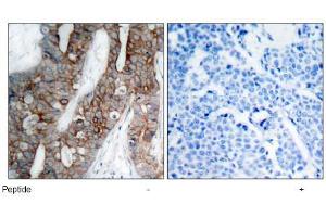 Image no. 1 for anti-Integrin beta 3 (ITGB3) (AA 771-775) antibody (ABIN197247) (Integrin beta 3 antibody  (AA 771-775))