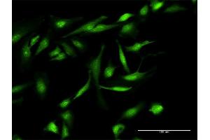 Immunofluorescence of purified MaxPab antibody to GEMIN7 on HeLa cell. (GEMIN7 antibody  (AA 1-131))