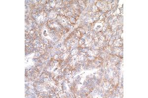 Immunohistochemistry (IHC) image for anti-CD276 (CD276) (AA 29-465) antibody (ABIN7455137) (Recombinant CD276 antibody  (AA 29-465))