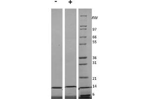 SDS-PAGE of Human Interleukin-3 Recombinant Protein (Animal Free) SDS-PAGE of Human Interleukin-3 Animal Free Recombinant Protein. (IL-3 Protein)