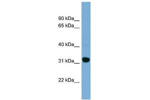 WB Suggested Anti-CBR1 Antibody Titration:  0.