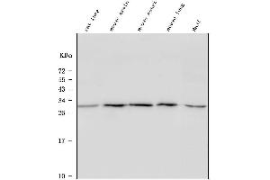Western blot analysis of ULBP1 using anti-ULBP1 antibody (ABIN7600996).
