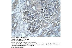 Human kidney (PNLIP antibody  (C-Term))