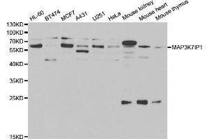 Western blot analysis of extracts of various cells, using TAB1 antibody. (TAB1 antibody)