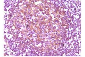 Immunohistochemistry (IHC) image for anti-CD14 (CD14) antibody (ABIN1843073) (CD14 antibody)