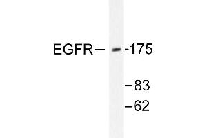 Image no. 1 for anti-Epidermal Growth Factor Receptor (EGFR) antibody (ABIN265396) (EGFR antibody)