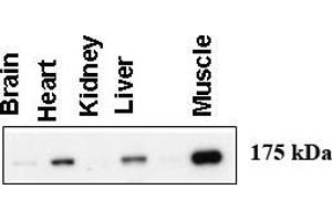Western blot using anti-AGL (C-term) antibody ((ABIN6243594 and ABIN6578916)) at 1:1000 dilution.