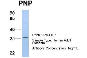 Host:  Rabbit  Target Name:  PNP  Sample Type:  Human Adult Placenta  Antibody Dilution:  1. (NP (Middle Region) antibody)