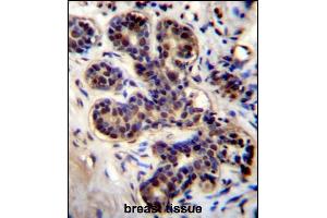 PROX2 Antibody (C-term) (ABIN656460 and ABIN2845744) immunohistochemistry analysis in formalin fixed and paraffin embedded human breast tissue followed by peroxidase conjugation of the secondary antibody and DAB staining. (PROX2 antibody  (C-Term))