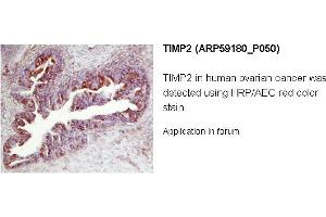 Image no. 1 for anti-Metalloproteinase Inhibitor 2 (TIMP2) (N-Term) antibody (ABIN2787967) (TIMP2 antibody  (N-Term))