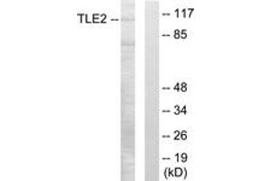 Western Blotting (WB) image for anti-Transducin-Like Enhancer Protein 2 (TLE2) (AA 211-260) antibody (ABIN2889550)