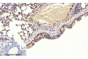 Immunohistochemical analysis of paraffin-embedded mouse lung tissue. (AKT1 antibody  (pThr308))