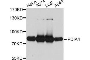 Western blot analysis of extracts of various cell lines, using PDIA4 antibody (ABIN5972424) at 1/1000 dilution. (PDIA4 antibody)