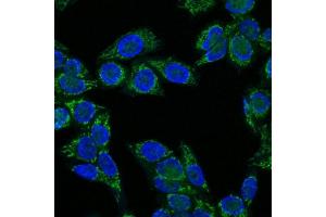 Immunofluorescence Analysis of HeLa cells labeling IGF-1 with IGF-1 Mouse Monoclonal Antibody (CTC05) labeled with CF647R (Green). (IGF1 antibody)