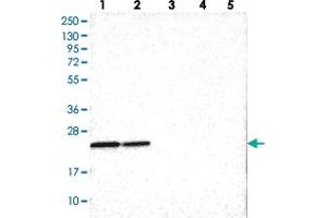 Western blot analysis of Lane 1: RT-4, Lane 2: U-251 MG, Lane 3: Human Plasma, Lane 4: Liver, Lane 5: Tonsil with SOX7 polyclonal antibody  at 1:100-1:250 dilution. (PINX1 antibody)