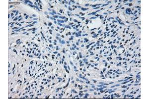Immunohistochemistry (IHC) image for anti-Cytochrome P450, Family 2, Subfamily E, Polypeptide 1 (CYP2E1) antibody (ABIN2718987)