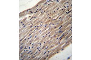 PLOD1 Antibody (N-term) (ABIN656585 and ABIN2845847) immunohistochemistry analysis in formalin fixed and paraffin embedded human heart tissue followed by peroxidase conjugation of the secondary antibody and DAB staining.