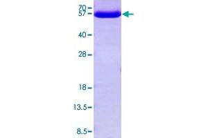 TXNRD1 Protein (AA 161-647) (His tag)