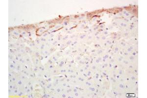 Formalin-fixed and paraffin embedded mouse liver labeled with Rabbit Anti FABP3/Cardiac FABP Polyclonal Antibody, Unconjugated (ABIN1387630) at 1:200 followed by conjugation to the secondary antibody and DAB staining (FABP3 antibody  (AA 8-100))