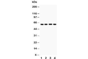 Western blot testing of HEXA antibody and Lane 1:  human placenta (Hexosaminidase A antibody  (C-Term))