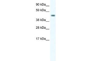 WB Suggested Anti-ELP4 Antibody Titration:  2. (ELP4 antibody  (Middle Region))