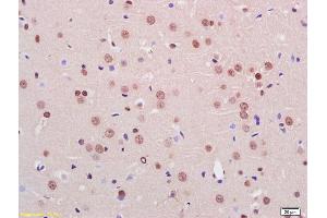 Formalin-fixed and paraffin embedded rat brain labeled with Rabbit Anti Phospho-HER3(Tyr1328) Polyclonal Antibody, Unconjugated (ABIN800628) at 1:200 followed by conjugation to the secondary antibody and DAB staining (ERBB3 antibody  (pTyr1328))