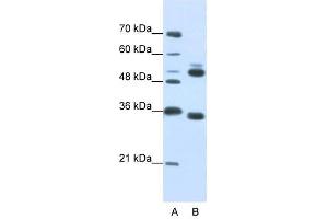 WDR6 antibody used at 0. (WDR6 antibody  (C-Term))