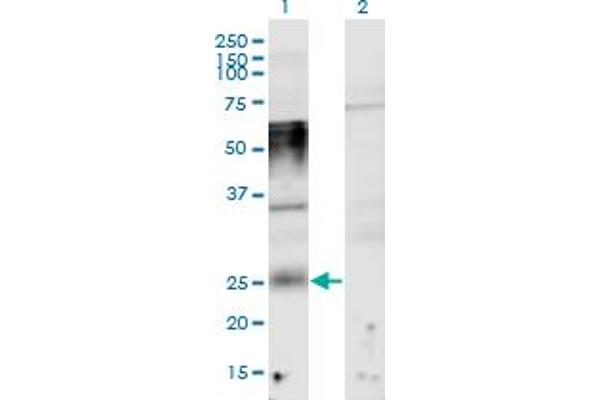 TMEM123 Antikörper  (AA 34-133)